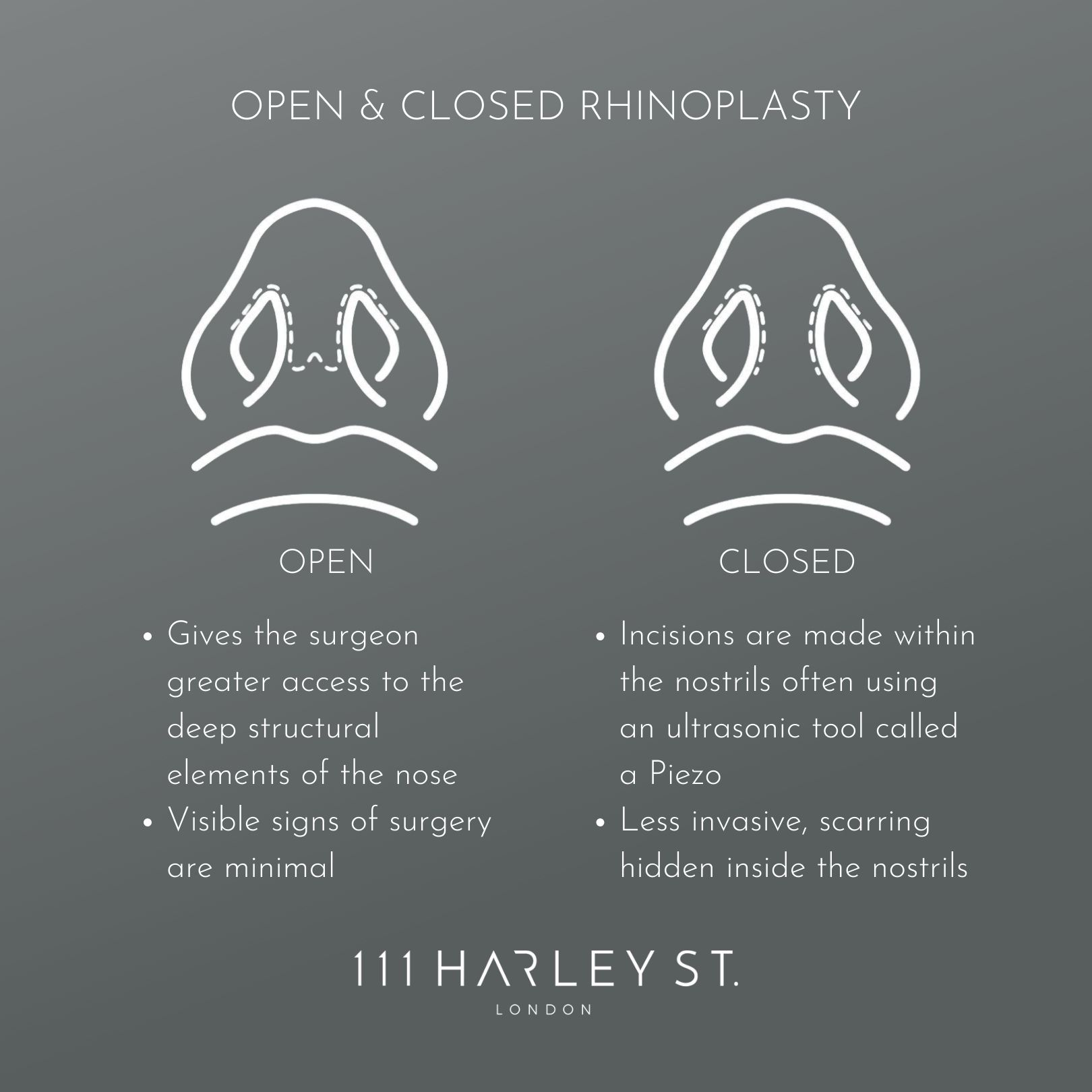 What is Rhinoplasty Surgery - Ask Dr Yannis