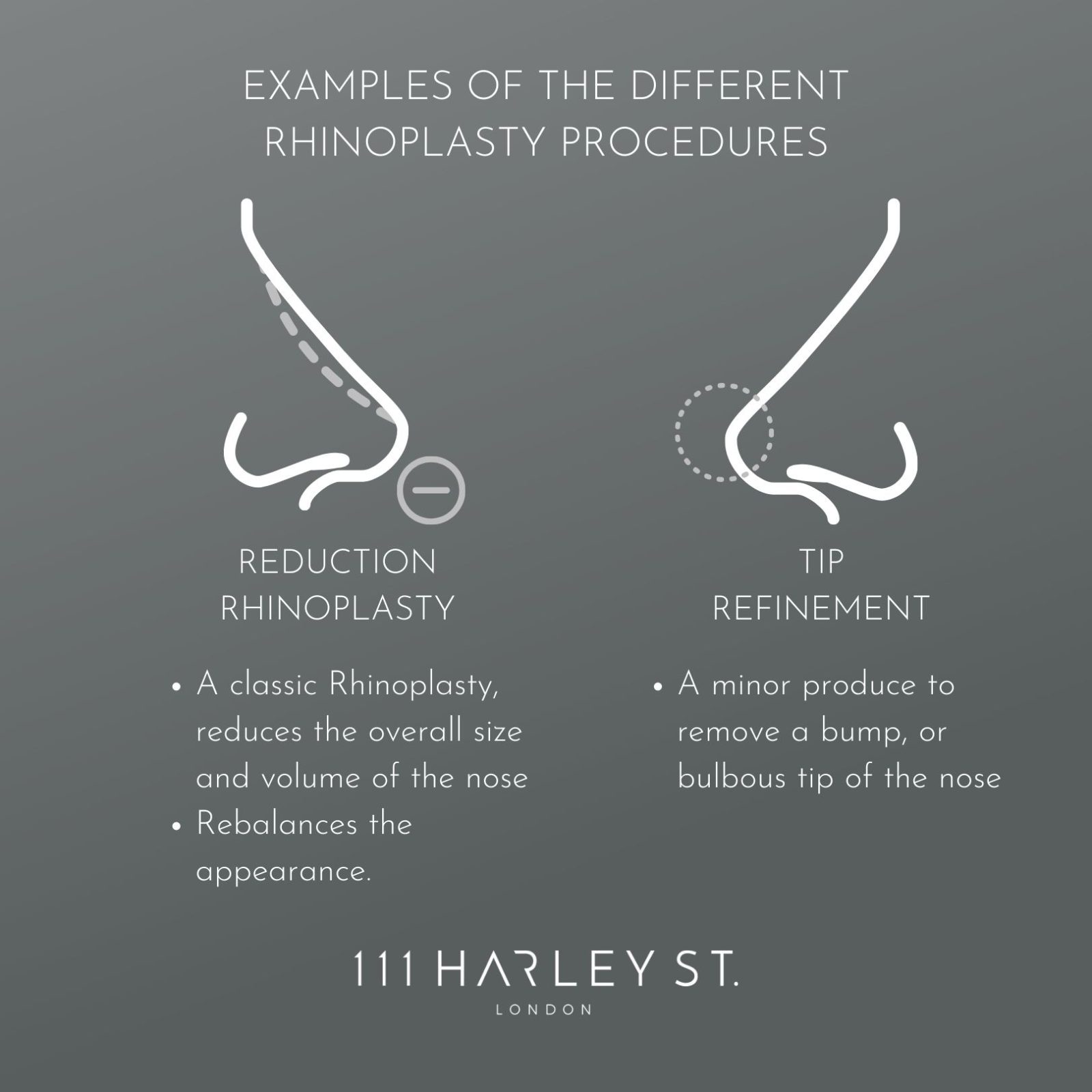 An image outlining the different Rhinoplasty techniques