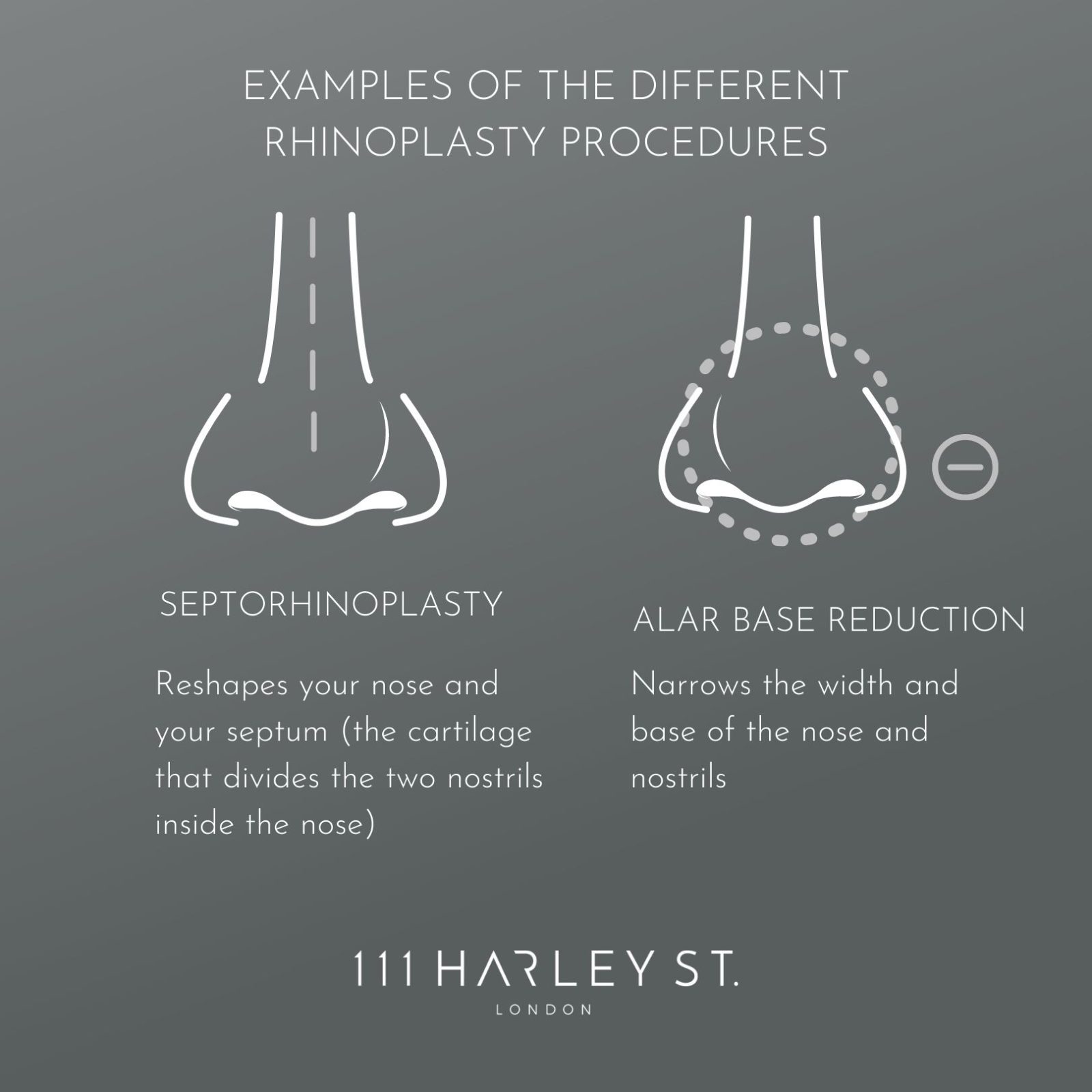 An image outlining the different Rhinoplasty techniques