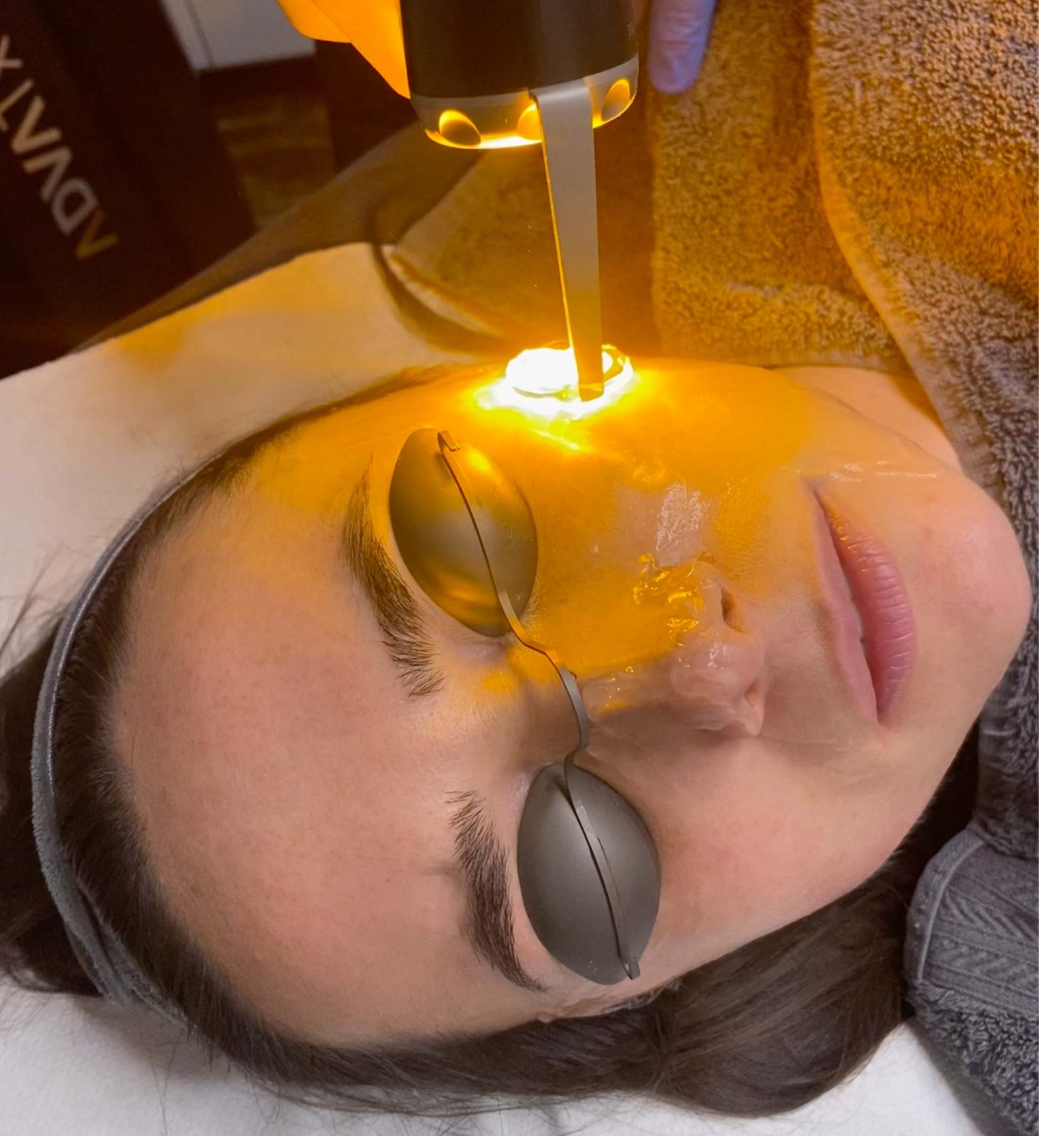 Woman having a yellow light laser treatment