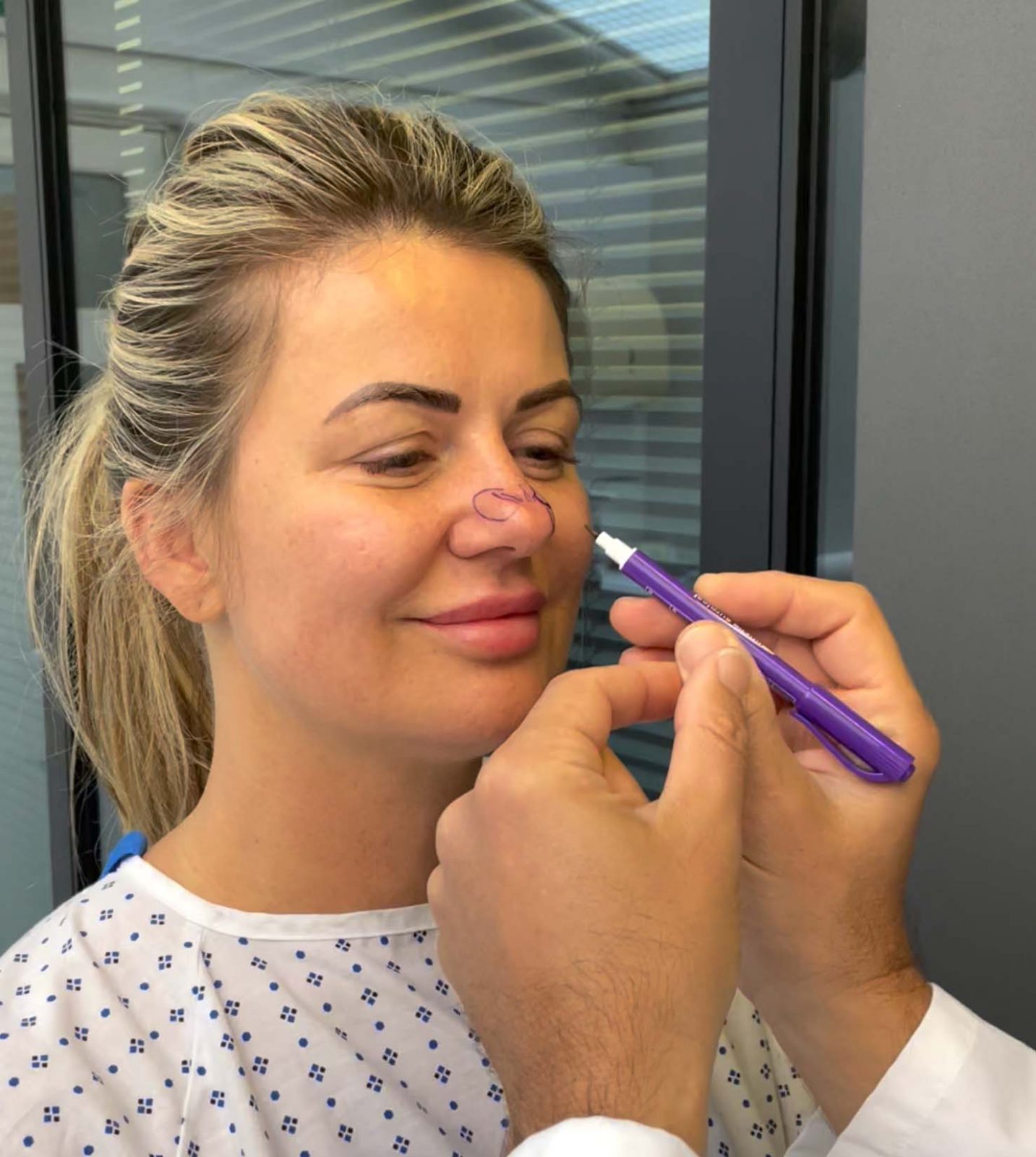 woman getting ready for surgery, a surgeon is marking her nose with pen