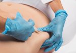 cosmetologist makes lipolytic injections to burn fat on the stomach and waist of a man. aesthetic cosmetology in a beauty salon.Cosmetology concept.