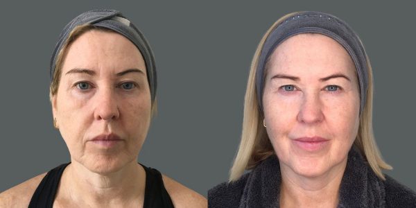 Potenza before & after