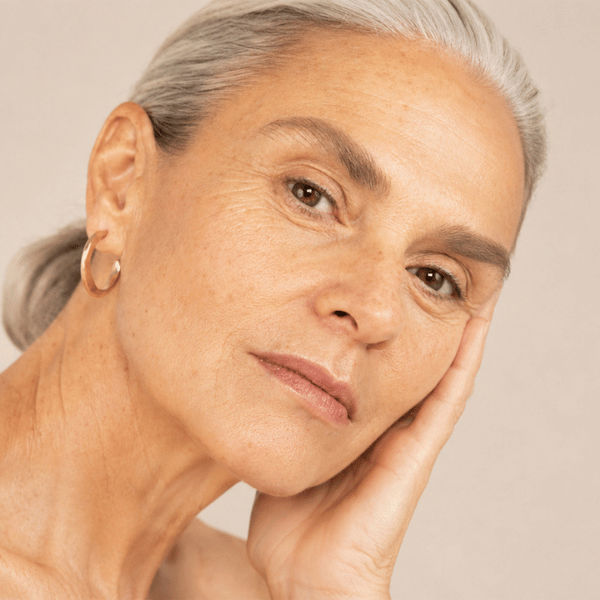 Potenza RF Microneedling