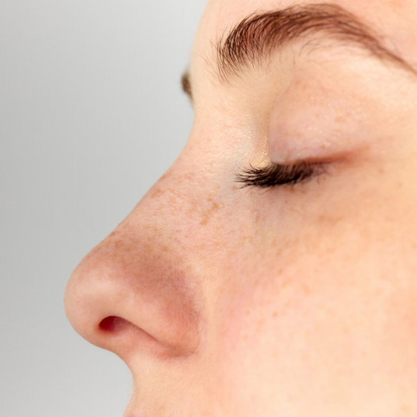Tip Refininement Rhinoplasty