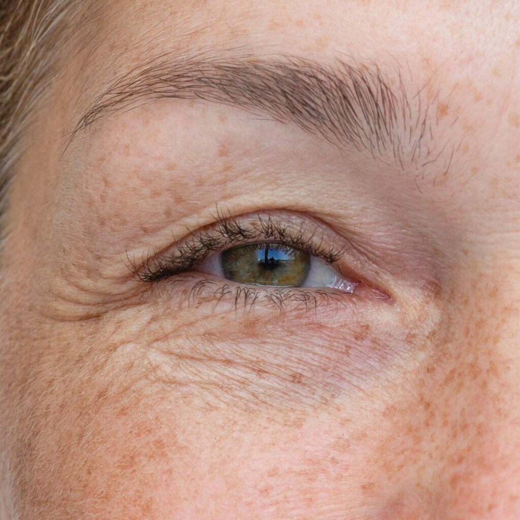 Lines and wrinkles