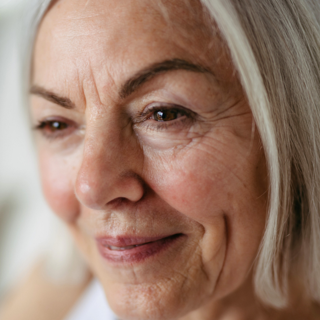 Skin Laxity